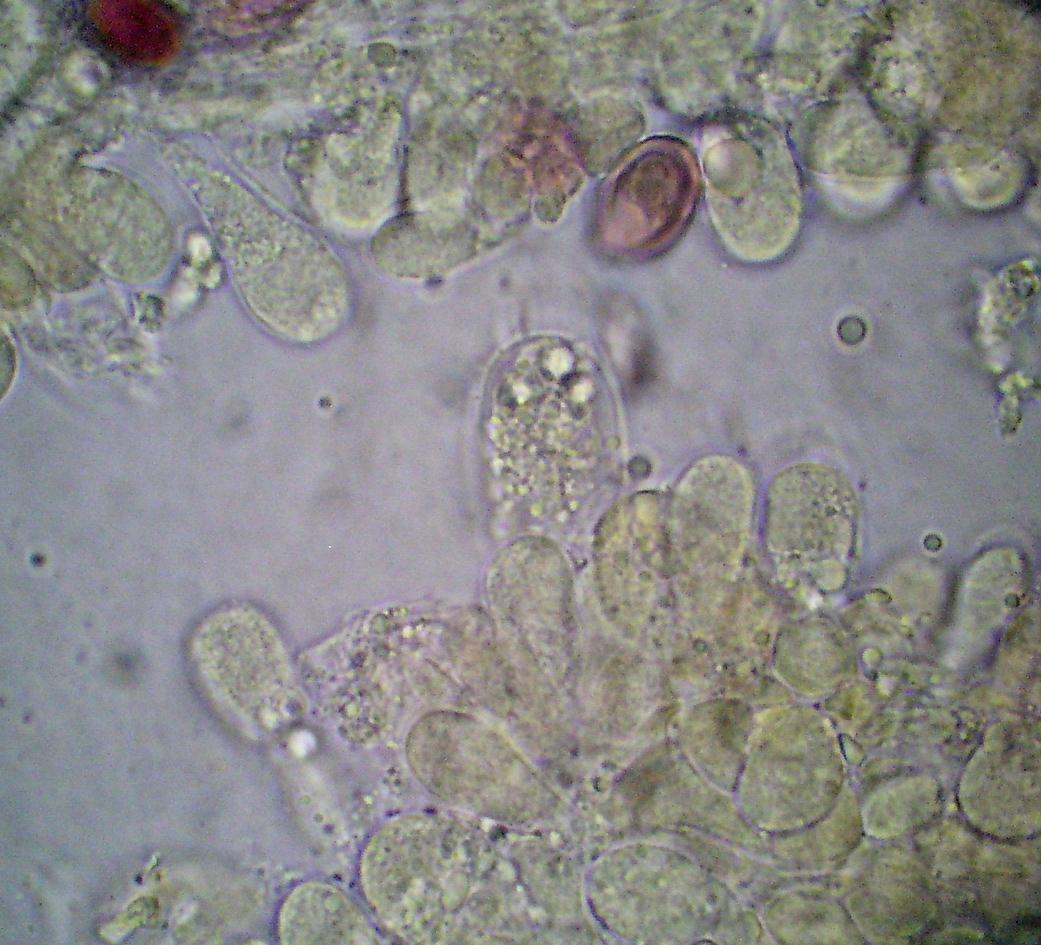 Macrolepiota sp. (cfr. Macrolepiota mastoidea)